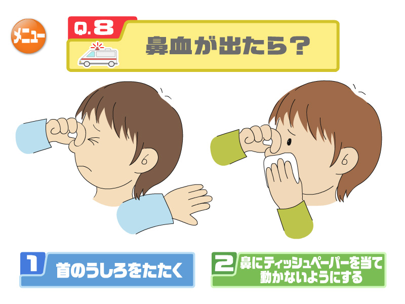 鼻血が出たら？