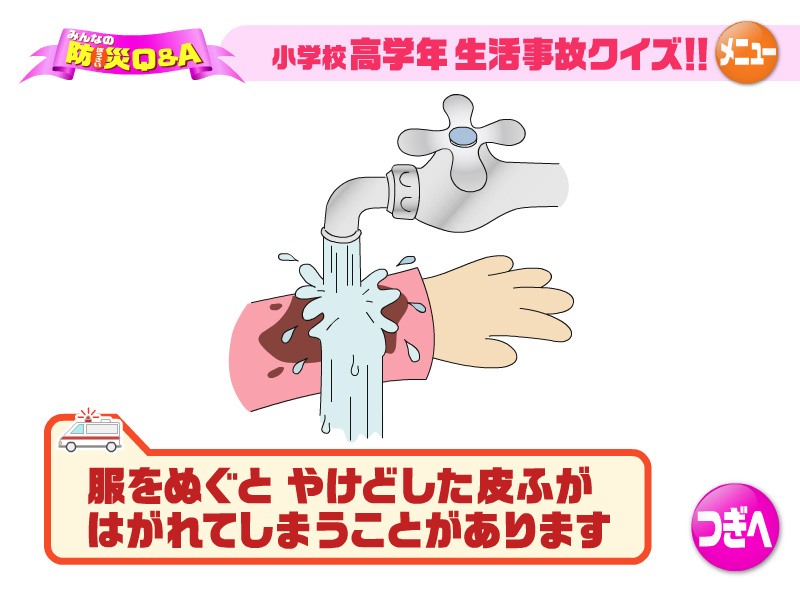 服をぬぐとやけどした皮ふがはがれてしまうことがあります